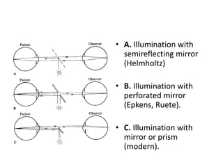 • A. Illumination with
semireflecting mirror
(Helmholtz)
• B. Illumination with
perforated mirror
(Epkens, Ruete).
• C. Illumination with
mirror or prism
(modern).

 