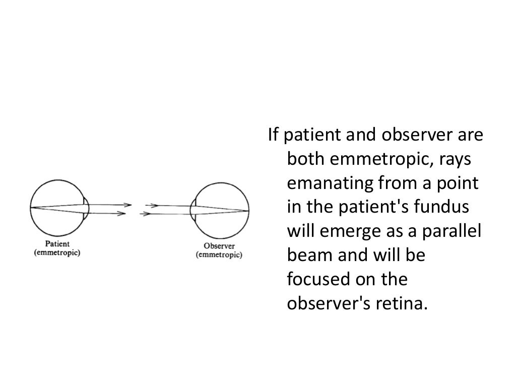 Direct Ophthalmoscopy