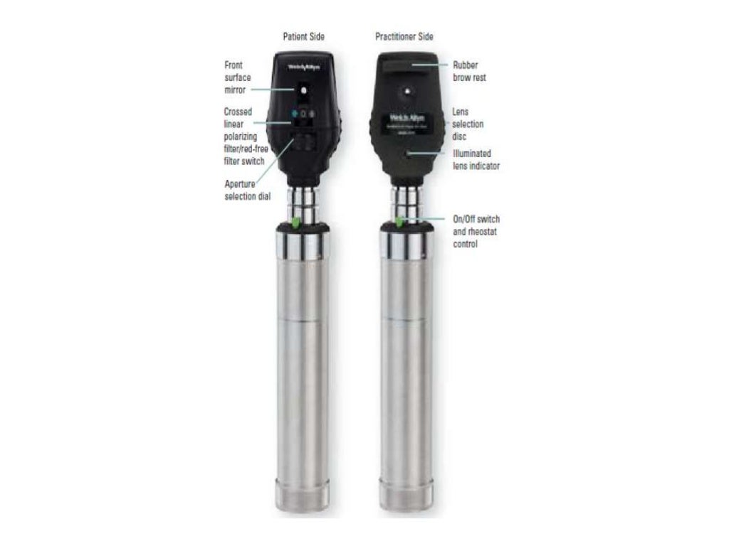 Direct Ophthalmoscopy