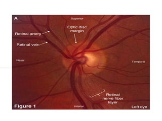 Fundoscopy a way to examine the retina.pptx