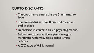 fundoscopy and papilledema ophthalmology [2].pptx