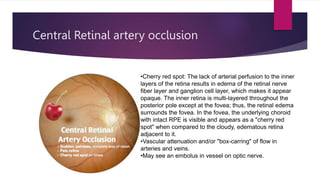 Fundoscopy images-1.pptx