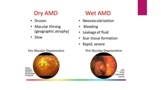 Fundoscopy images-1.pptx