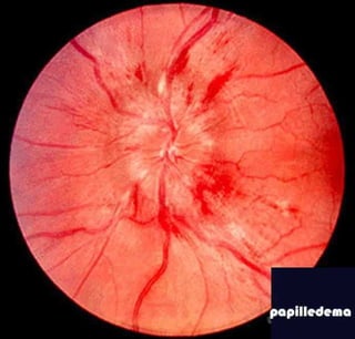 Fundus examination