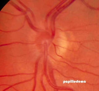 Fundus examination
