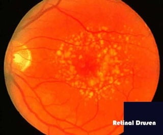 Fundus examination