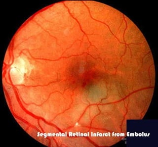 Fundus examination