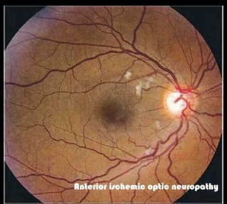 Fundus examination