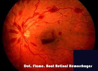 Fundus examination