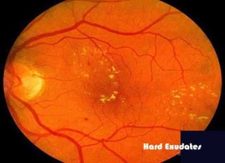 Fundus examination
