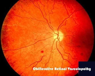 Fundus examination