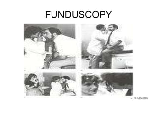 FUNDUSCOPY ,[object Object]