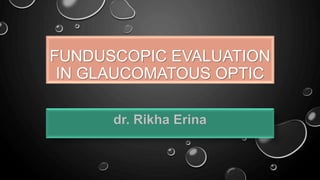 FUNDUSCOPIC EVALUATION
IN GLAUCOMATOUS OPTIC
dr. Rikha Erina
 