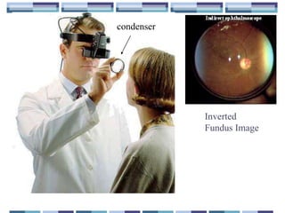 Funduscopy | PPTX