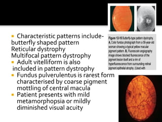 hereditary macular and choroidal dystrophies | PDF