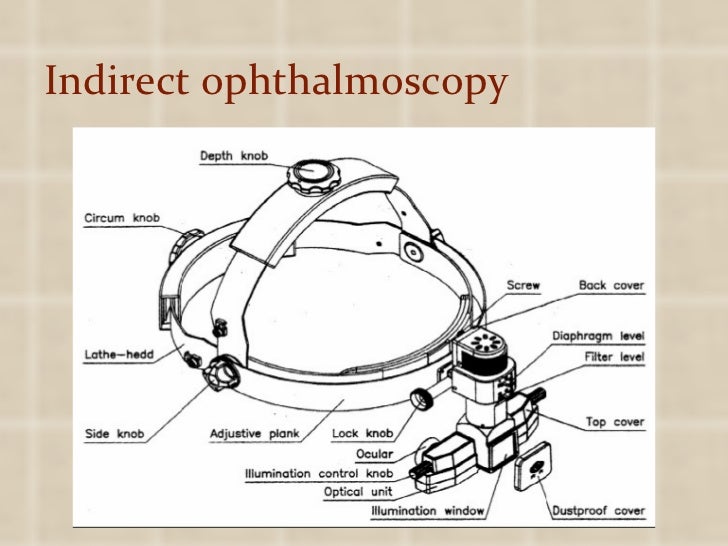 Fundus Examination