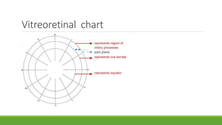 Vitreoretinal chart
 