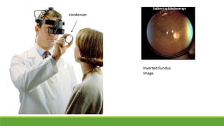 condenser
Inverted Fundus
Image
 