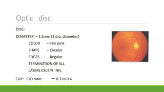 Optic disc
DISC:
DIAMETER – 1.5mm [1 disc diameter]
COLOR – Pale pink
SHAPE – Circular
EDGES – Regular
TERMINATION OF ALL
LAYERS EXCEPT NFL
CUP: C/D ratio – 0.3 to 0.4
 