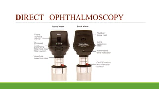 DIRECT OPHTHALMOSCOPY
 