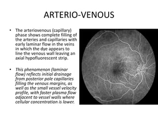 ARTERIO-VENOUS
• The arteriovenous (capillary)
phase shows complete filling of
the arteries and capillaries with
early laminar flow in the veins
in which the dye appears to
line the venous wall leaving an
axial hypofluorescent strip.
• This phenomenon (laminar
flow) reflects initial drainage
from posterior pole capillaries
filling the venous margins, as
well as the small vessel velocity
profile, with faster plasma flow
adjacent to vessel walls where
cellular concentration is lower.
 
