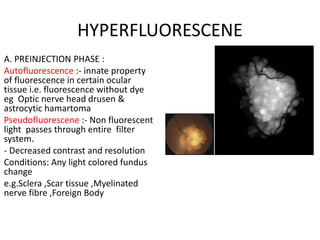 HYPERFLUORESCENE
A. PREINJECTION PHASE :
Autofluorescence :- innate property
of fluorescence in certain ocular
tissue i.e. fluorescence without dye
eg Optic nerve head drusen &
astrocytic hamartoma
Pseudofluorescene :- Non fluorescent
light passes through entire filter
system.
- Decreased contrast and resolution
Conditions: Any light colored fundus
change
e.g.Sclera ,Scar tissue ,Myelinated
nerve fibre ,Foreign Body
 
