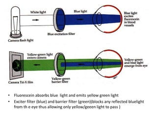 • Fluorescein absorbs blue light and emits yellow green light
• Exciter filter (blue) and barrier filter (green)(blocks any reflected bluelight
from th e eye thus allowing only yellow/geeen light to pass )
 