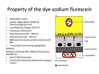 Property of the dye-sodium flurescein
• Yellow Red in color.
• Stable, Highly Water Soluble &
Pharmacologically inert.
• Low Molecular Weight 376.27 D
• Fluoresces at Blood pH
• Peak absorption 465 – 490 nm
• Peak emission 520 – 530 nm
• 80% bound to plasma protein and also with
RBC
• remaining is seen during angiography
DOSAGE :
Solution containing 500 -100mg of fluorescien
available as :
• 5ml of 10% fluorescein
• 3ml of 25% fluorescien (preferred in opaque
media )
 