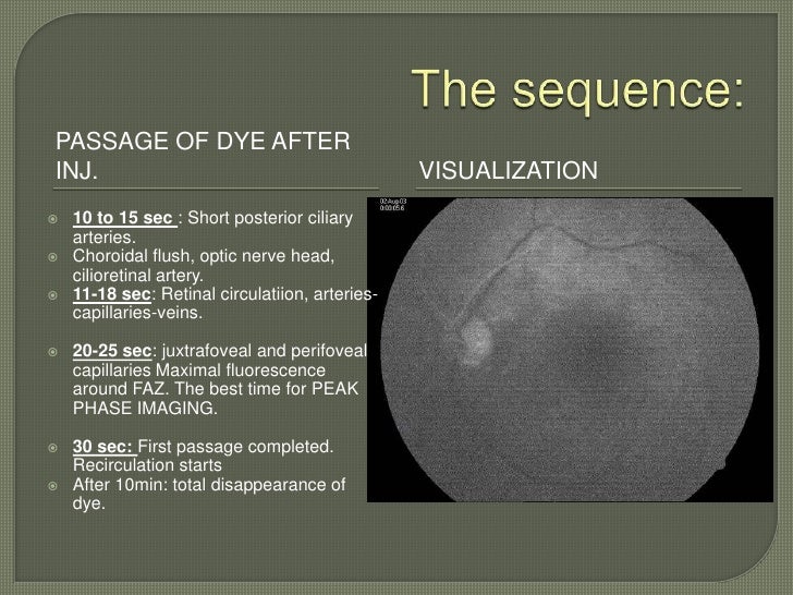 Fundus fluorescein angiography
