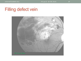 Window Defect Ffa Hyper DR WANI'S TALK ON Fundus fluorescein angiography PART II for post ...