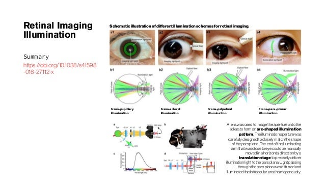 4141 red sclera contacts