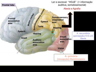 A. primária 
(recepção) Hemianopsia 
A. secundária (percepção) H-O-J-E Alexia 
A. de associação terciarias ou multimodais 
(comparação com informação procedente de outros sentidos) 
Ler e escrever “HOJE” (+ informação auditiva, somatosensorial) 
Alexia e Agrafia  
