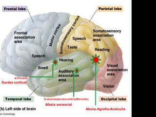 A.Primária 
A.associação-secundária(Wernicke) 
Surdez cortical 
Afasia sensorial 
Alexia-Agrafia-Acalculia  