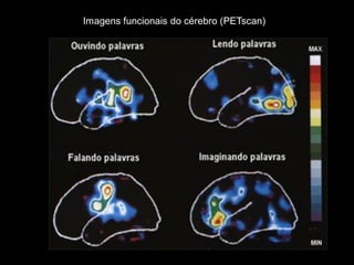 Imagens funcionais do cérebro (PETscan)  