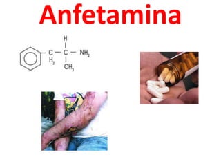 Anfetamina