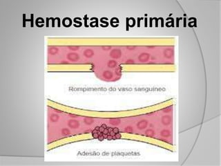 Hemostase primária
 