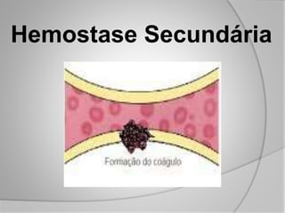 Hemostase Secundária
 