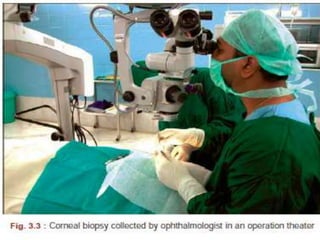 2.PARACENTESIS
• deep stromal lesions with outpouchings into AC.
• done with 2 cc 26 G tuberculin syringe.
3. KERATECTOMY /BIOPSY
• If corneal scrapings for smears and cultures are negative
• procedure
• performed in the minor OT / slit lamp
• under topical /eyelid and retrobulbar anesthesia.
• a round 2 to 3mm sterile disposable dermatologic trephine is
used 4 partial thickness trephination to take both clinically
infected area & the adjacent clear cornea.
• Care is taken to avoid the visual axis, if possible.
• The base is then undermined with a surgical blade to
complete the lamellar keratectomy.
• superior to corneal scraping for the isolation of the fungal
organisms.
 