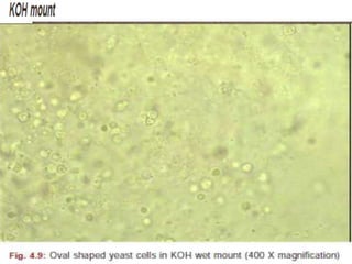 LABORATORY DIAGNOSIS
• direct microscopy
• fungal cultures
• Polymerase chain reaction (PCR)
• Confocal microscopy
• DIRECT MICROSCOPY
• uses KOH wet mount preparation and smears,
• stained by Gram and Giemsa stain.
NOCARDIA : SLENDER THIN FILAMENTS
 