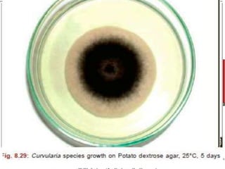 • MICROSCOPIC EXAMINATION METHODS
• direct examination of a portion of slide
• adhesive tape technique
• slide culture technique
 