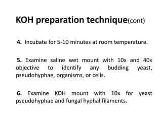 Koh Tablet Method Fungal corneal-ulcer-final | PPTX