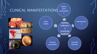 Human
infection
s
involving
biofilms
Native
valve
endocarditi
s
Periodontiti
s
Corneal
infection
Chronic
prostatitis
Otitis
media
CLINICAL MANIFESTATIONS
 