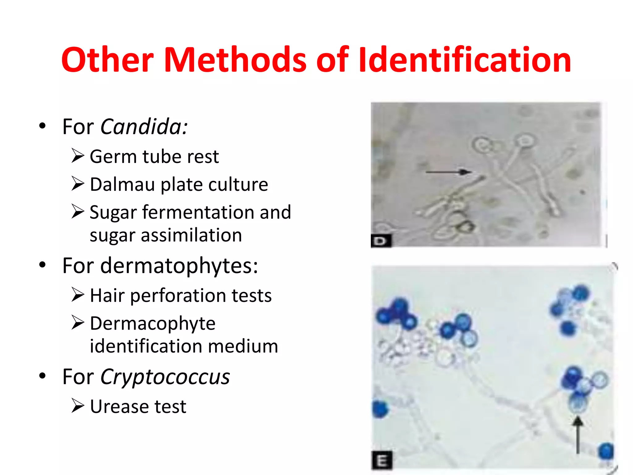 Fungal diagnosis | PPTX