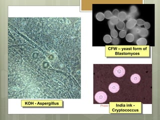 27.05.09
Phase I/ Module VII Dr Ekta
CFW – yeast form of
Blastomyces
KOH - Aspergillus India ink -
Cryptococcus
 