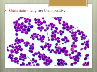  Gram stain – fungi are Gram positive
 