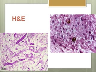 H&E
 