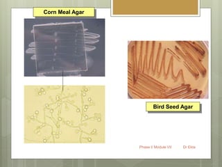 Phase I/ Module VII Dr Ekta
Corn Meal Agar
Bird Seed Agar
 