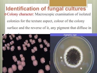 Identification of fungal cultures
Colony character: Macroscopic examination of isolated
colonies for the texture aspect, colour of the colony
surface and the reverse of it, any pigment that diffuse in
the medium.
 