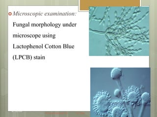 Microscopic examination:
Fungal morphology under
microscope using
Lactophenol Cotton Blue
(LPCB) stain
27.05.09
Phase I/ Module VII Dr Ekta
 