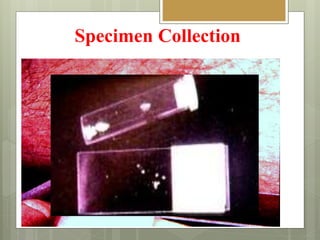 Specimen Collection
 